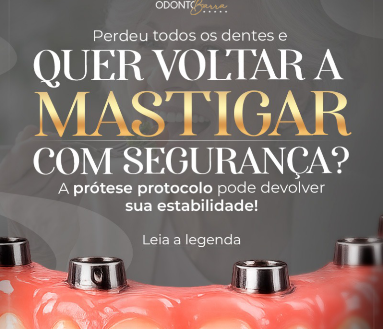 Perdeu todos os dentes? Entenda como a prótese protocolo devolve segurança para mastigar 🦷✨