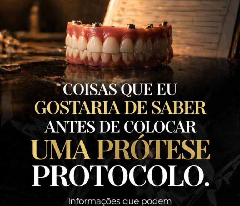 7 coisas que eu gostaria de saber antes de colocar uma prótese protocolo 🦷✨