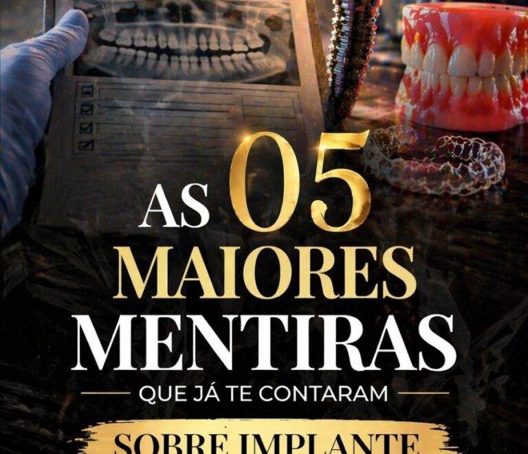 As 5 Maiores Mentiras Que Já Te Contaram Sobre Implante Dentário 🦷⚠️
