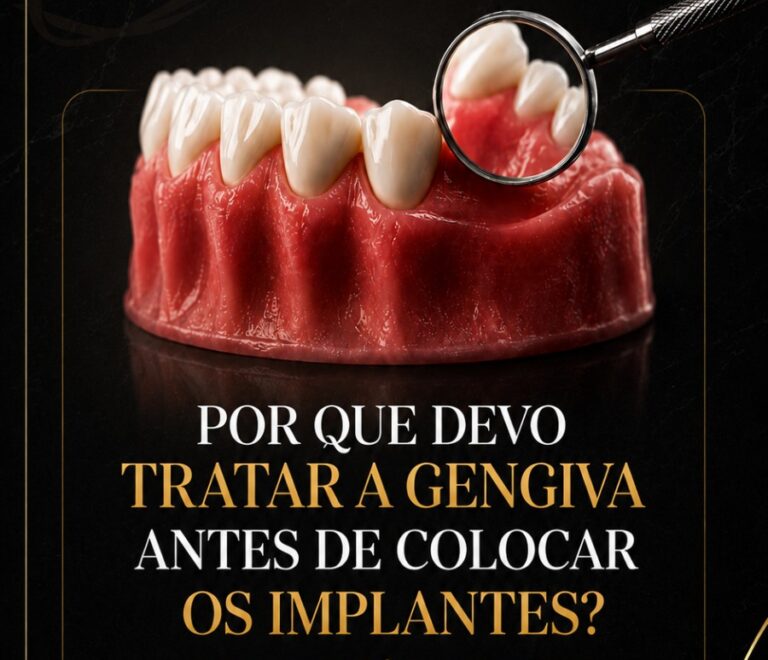 Por Que Devo Tratar a Gengiva Antes de Colocar os Implantes? 🦷✨